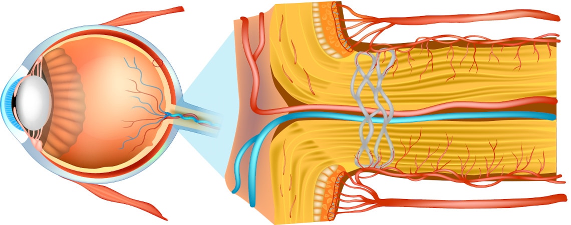 anatomie de l'oeil, schema du nerf optique, maladie de Leber